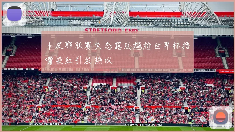 卡皮耶联赛失态露底尴尬世界杯捂嘴染红引发热议
